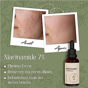 Sérum Niacinamide (Vitamine B3) 7%